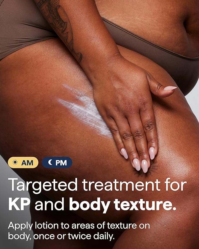 Remedy for Body Bumps | KP Exfoliating Body Moisturizer | Keratosis Pilaris (KP) Treatment For Textured, Crepey Skin with Urea, Lactic Acid, Retinol | Smoothing Body Lotion | By Dermatologist Dr. Shah