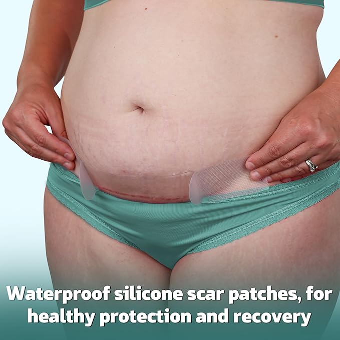 Mama & Wish® C-Section Recovery Kit Must Haves - Postpartum Essentials 12-Piece Set with Belly Binder, No-Shower Wipes, Silicone Scar Patches, Peri Bottle, Underwear, Grip Socks & Toiletry Bag
