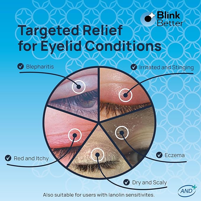 Lanolin Free Eyelid Ointment 10g – For Sensitive & Dry Eyelids - Hydrates, Nourishes & Soothes – Moisturising Care for Dry, Itchy, Red, Sensitive, Flaky Skin Around the Eyes