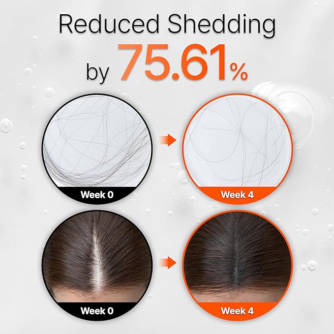 lilyeve GROWTURN Hair Growth Serum with Built-in Brush, Heartleaf-Derived Exosomes to Revitalize & Thickening Hair, Hair Growth Accelerator - Korean Hair Care, 1.01 fl. oz. (Pack of 1)