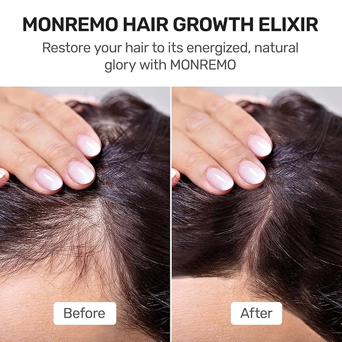 Hair Growth Serum with Turmeric, Caffeine & Biotin – Fast-Absorbing Hair Thickening Serum & Scalp Treatment for Men & Women – Lightweight Vegan Formula for Thinning, Weak Hair Regrowth