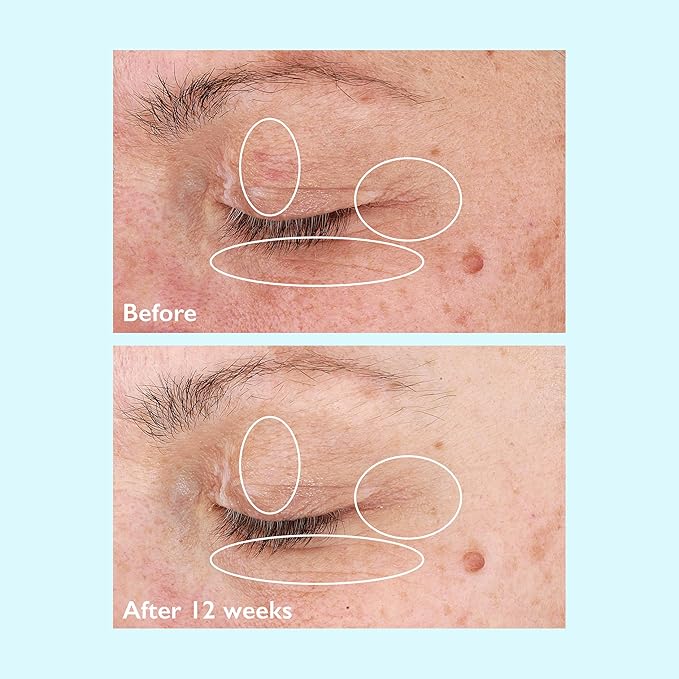 Restorsea Revitalizing Eye Cream – Reduces Dark Circles & Crow’s Feet – Anti-Aging Eye Treatment with Vibransea™ Complex, Hesperidin & Oat Extract – Ophthalmologist Tested, Clean, Hypoallergenic 0.5oz