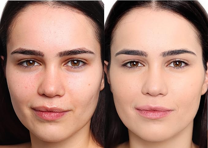 The Good Mineral Loves-You-Back 3in1 Mineral Powder Foundation (BEIGE 2) | Designed for Rosacea, Acne-Prone, Sensitive Skin | 3IN1 - Concealer, Powder and Foundation | Natural + Lightweight Coverage