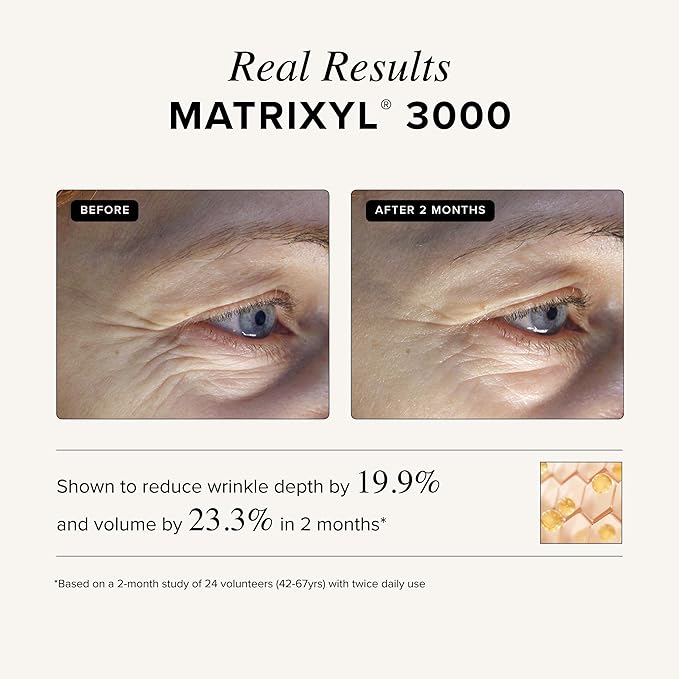 Asterwood Matrixyl 3000 + Argireline Serum with Hyaluronic Acid - Anti-Aging, Wrinkle Reducing, Collagen Boosting - Fragrance-Free - 2 Fl Oz