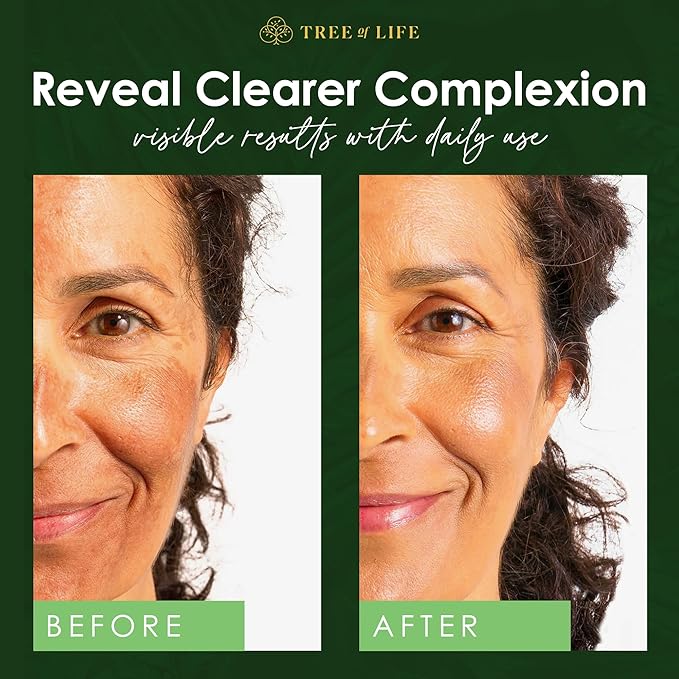 Tree of Life Beauty Skin Care Set, Brightening, Firming, Dry Face, Dermatologist Tested - Complete Hydration Trio, Vitamin C Serum, Niacinamide, Pro Collagen Peptide, 3 count of 1Fl oz