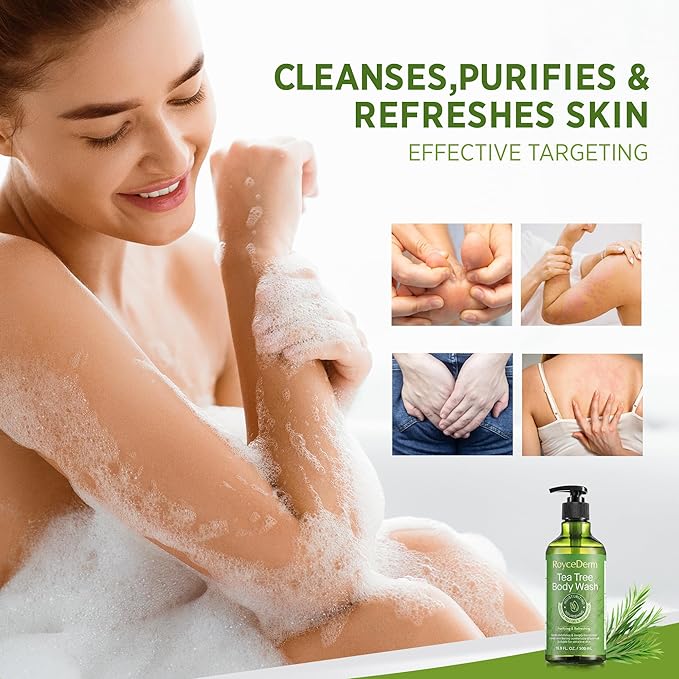 Roycederm Antifungal Body Wash & Soap, Antibacterial, Tinea Versicolor, Tea Tree Body Wash, Back Acne, Folliculitis, For Jock Itch, Athletes Foot, Body Odor, Ringworm