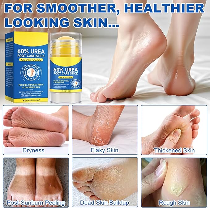 60% Urea Foot Cream, 1.41Fl Oz Foot Cream Maximum Strength Moisturizer for Dry Cracked Heels, Urea Foot Lotion Nourish Cracking Rough Dry Hands/Feet, Feet Callus Remover (2Pack)