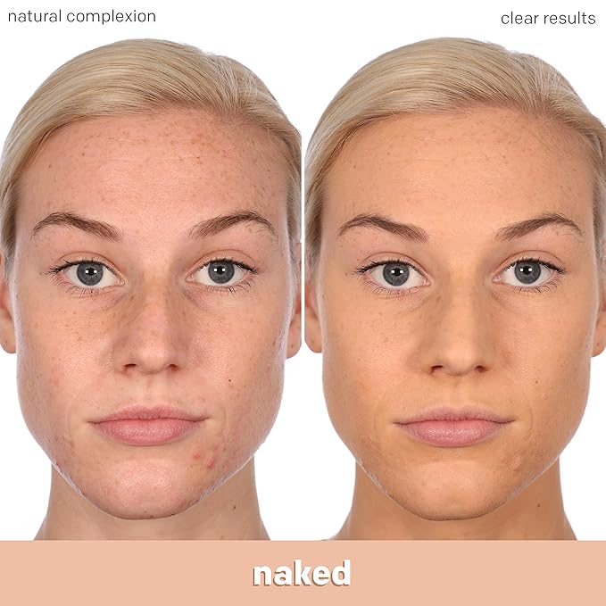 Almay Clear Complexion Acne Foundation Makeup with Salicylic Acid - Lightweight, Medium Coverage, Hypoallergenic, Fragrance-Free, for Sensitive Skin, 400 Neutral, 1 fl oz. (Pack of 4)