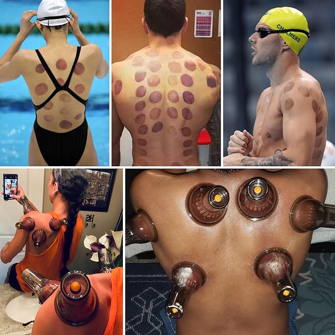Cupping Therapy Set w/ 18 Massage Cups for Pain Relief Physical Therapy Cupping Kit for Massage Therapy with Vacuum Pump, Black Box