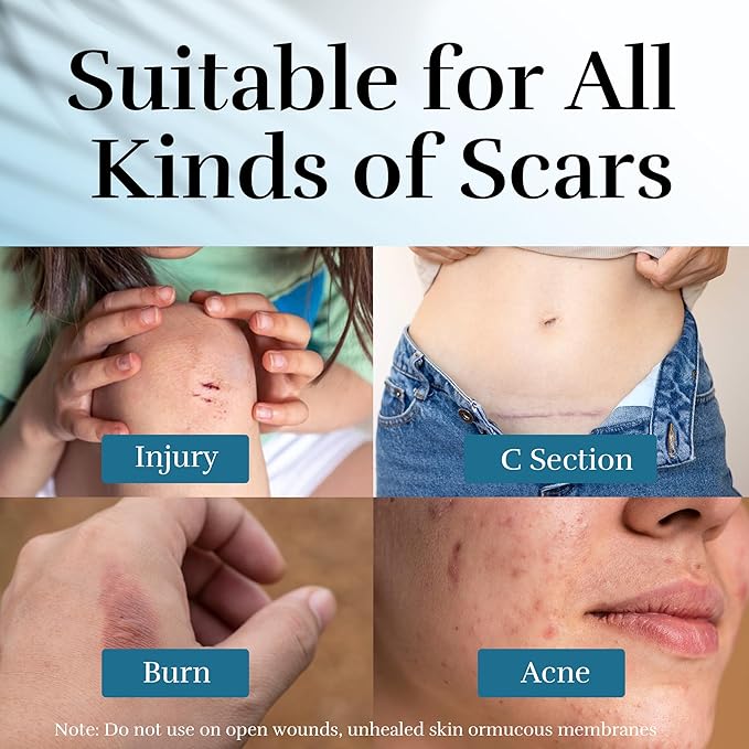 Advanced Scar Cream, Scar Reduction Treatment for Improves Skin Texture & Helps Remove Acne, Stretch Marks, Surgery, C Section, Burn, Keloid & Hypertrophic Scars 1.76 Oz (50g)