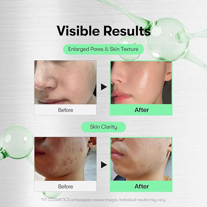 VT COSMETICS CICA Reedle Shot 300, Advanced Night Exosome, Microneedling Serum, Centella Asiatica, Hyaluronic Acid, Propolis, Soft Skin, Regeneration, Glass Skin, Korean Skin Booster 1.69Fl Oz (50ml)