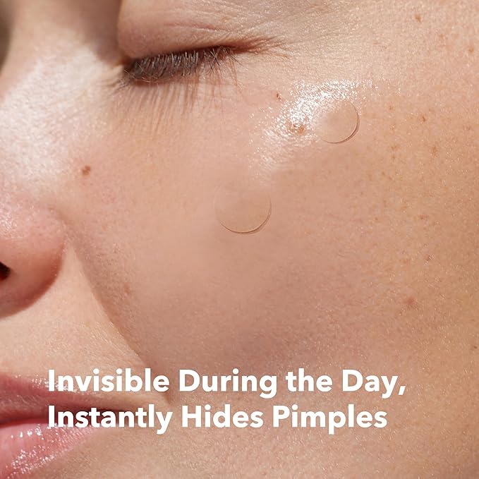 AVARELLE Invisible Acne Spot Patch (24 Count) Ultra Thin Hydrocolloid Spot Sticker for Day Time Acne l For Covering Zits & Blemish with Calendula, Rosehip Seed, Vegan, Cruelty Free