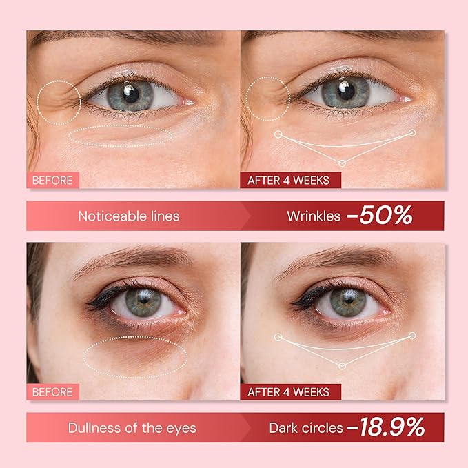 Anti Aging Eye Cream for Wrinkles: Retinol & Polypeptide Under Eye Treatment - Reduce Dark Circles, Puffiness, Crows feet - Repair Women's Eyes Contour, 0.95 fl. oz
