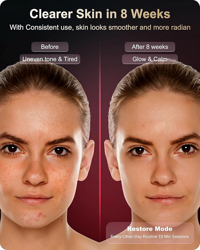 Lumefu Nimbus FDA-Cleared Light Therapy Mask, 3 Mode LED with Red, Near Infrared &Blue for Anti-Aging, Acne &Skin Rejuvenation, Roll to Pack OdorFree, Full face Comfort Fit, Cordless, USBC Recharge