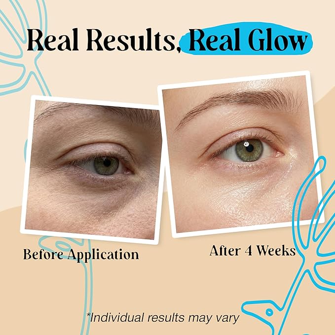 2 Pk 20g Under Eye Balm Stick Hydrating | 0.7 Oz Moisturizing Under Eye Brightener Stick w/Retinol, Aloe Vera, Vit E | Plumps, Hydrates & Reduces Dark Circles & Puffiness | Korean Skincare Inspired