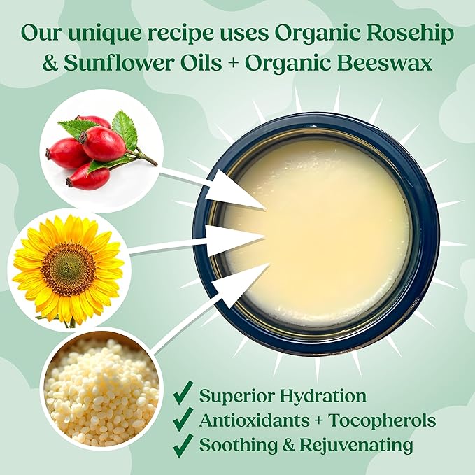 Organic Beef Tallow Bag Balm with Frankincense, Lavender, & Rosehip Oil, 1 oz – Hand Made in USA Tallow Moisturizer for Dry, Sensitive Skin, Rosacea, Eczema | Natural Hydration for Face & Body