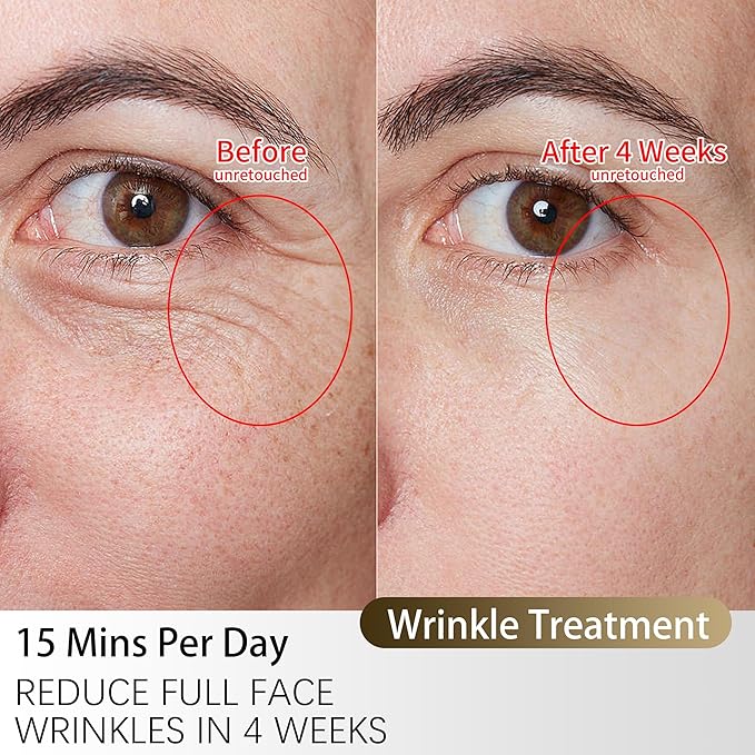 TASNEEM Red Light Therapy for Face, 3D Red Light Therapy Mask with 312 LEDs for Full-face Wrinkles & Acne, 3 Modes with Red & Blue 850nm Near-Infrared Light Therapy Mask, FDA-Cleared, Remote Control