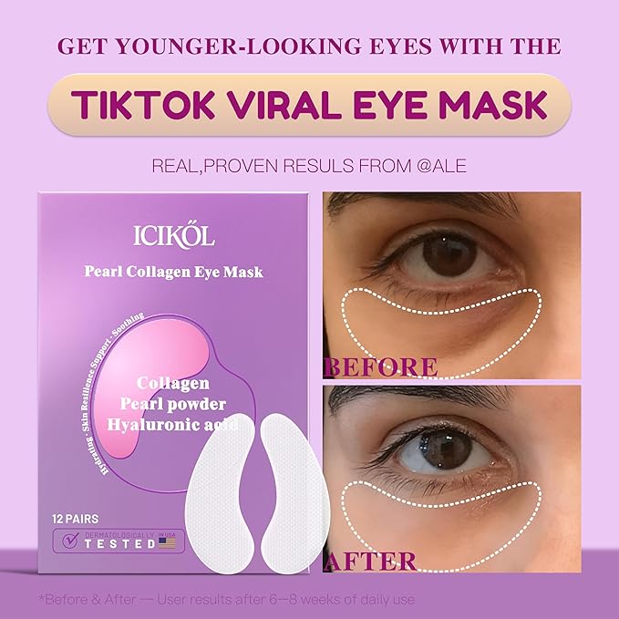 Hyaluronic Acid Collagen Under Eye Patches, Eye Mask for Puffy Eyes and Dark Circles, Deep Hydrating Eye Mask Patches for Eye Bags Treatment, Under-eye Skincare for All-day Moisture (24 pairs)