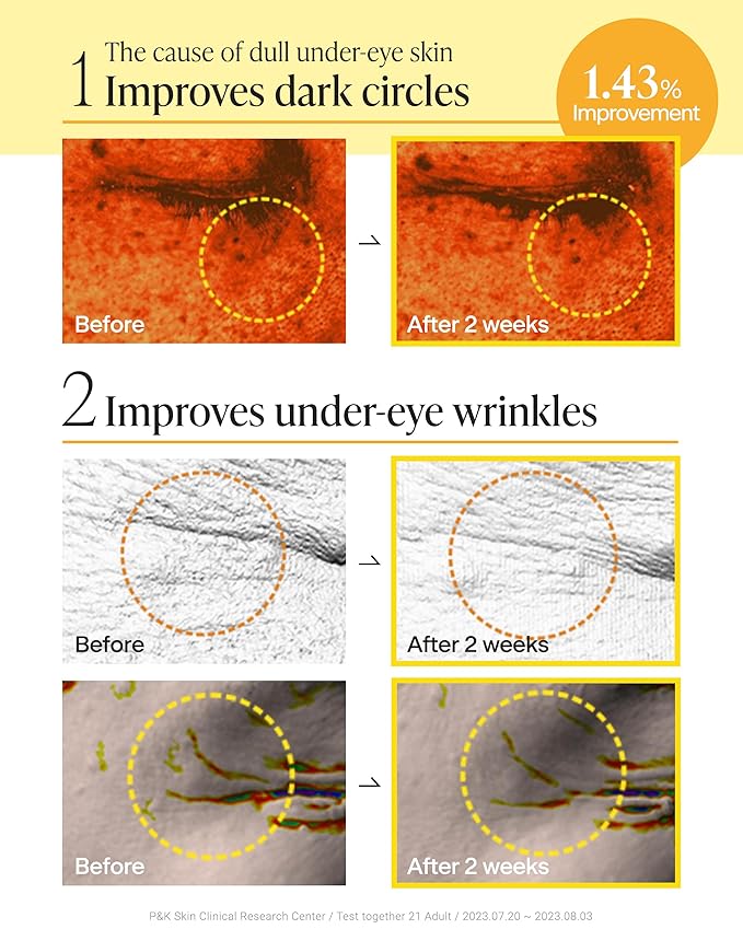 Korean Under Eye Patches for Dark Circles & Puffiness – Vita 500Da Fabric-Free Collagen Gel, 83% French Collagen + Niacinamide & Peptides, Cooling Depuffing, Turns Clear, 60 Patches