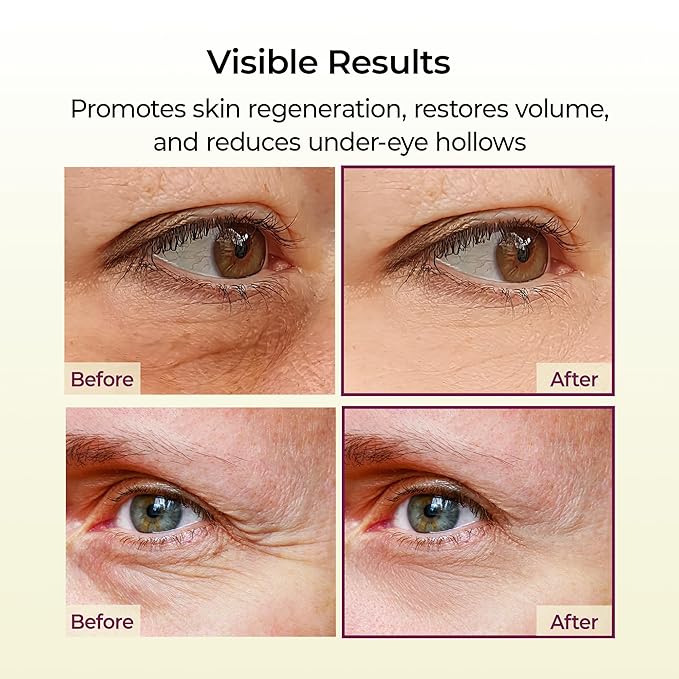 Dr.Melaxin Cemenrete Calcium Multi Balm 9g Korean Skin Care All In One Stick Collagen Face Eye treatment Balm