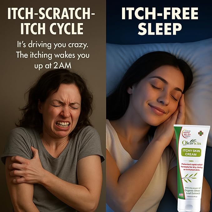Oleavicin Organic Extra Strength Anti-Itch Cream for Dry, Itchy Skin Relief Natural Fungal & Rash Treatment with Olive Leaf Extract Fast-Acting, Long-Lasting Relief