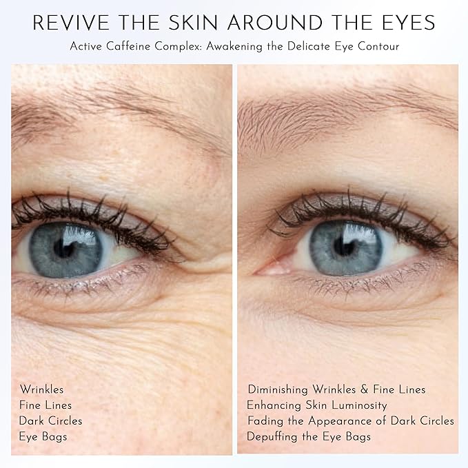 Caffeine Eye Cream - Eye Cream with Caffeine & Niacinamide for Dark Circles and Puffiness, Under Eye Treatment Reduces Puffy Bag & Fine Line, Hydrating & Brightening Eye Area Skin Care for Women & Man