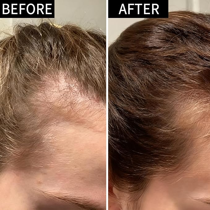 Hair Growth Serum with Biotin & Ginseng - Hair Loss Treatment for Men & Women, Scalp Care Solution for Thinning Hair, Plant-Based Formula for Fuller Looking Hair