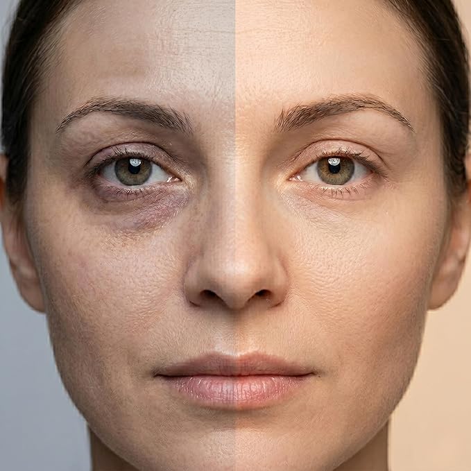 Vitamin K1 Oxiderm Cream Minimizing Appearance of Old and New Scars, Dark Eye Circles, Bruises, Varicose Veins, Redness Relieve 1.01Oz