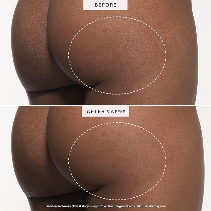 JLO BEAUTY Booty Balm, Skin Firming Cream for Butt, Hips, Thighs & Arms, Enriched with Hyaluronic Acid, Shea Butter, Avocado, and Squalane, Firm + Flaunt Targeted Body Moisturizer for Women, 4.2 Oz