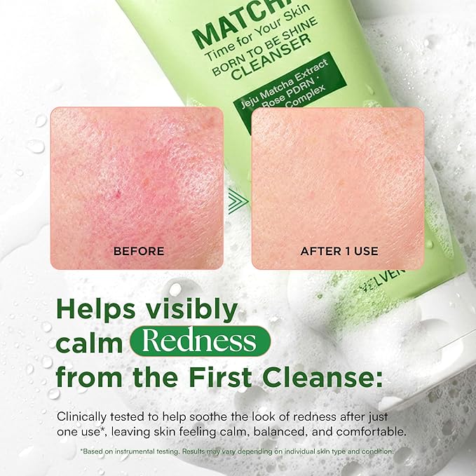 Matcha Gentle Deep Pore Cleansing Facial Cleanser, Low-pH Face Wash for Pore Refining, Rose PDRN Hydrating Daily Facial Wash Redness & Sensitive Skin Friendly, Korean Skincare(5.07 fl.oz.)