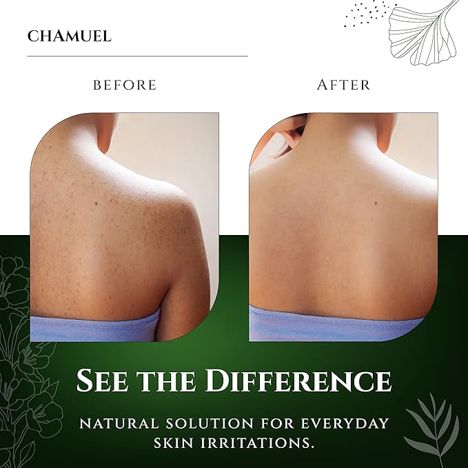 Chamuel Tea Tree Body Wash - Made With Natural Ingredients To Fights Itchy Skin, Body Odor, Athlete's Foot, Jock Itch & Toenails Issues - Organic Scented - Men & Women (11.8oz) 2-Pack