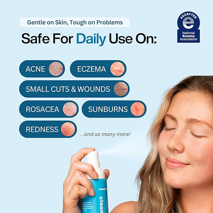 Hypochlorous Acid Spray – Dermatologist Tested HOCl Facial Cleanser for Sensitive, Acne-Prone & Irritated Skin – Soothes Redness, Eczema, Rashes & Itching – Skin Repair Spray, 2oz + 2oz, Honeydew Labs