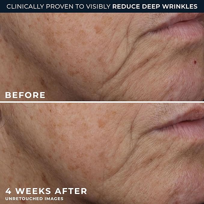 RoC Deep Wrinkle Rich Cream, Fragrance Free, Daily Anti-Aging Firming Cream For Persistent Dryness & Younger-Looking Skin For Women & Men, With Line Smoothing Eye Cream Packette, 1.7oz