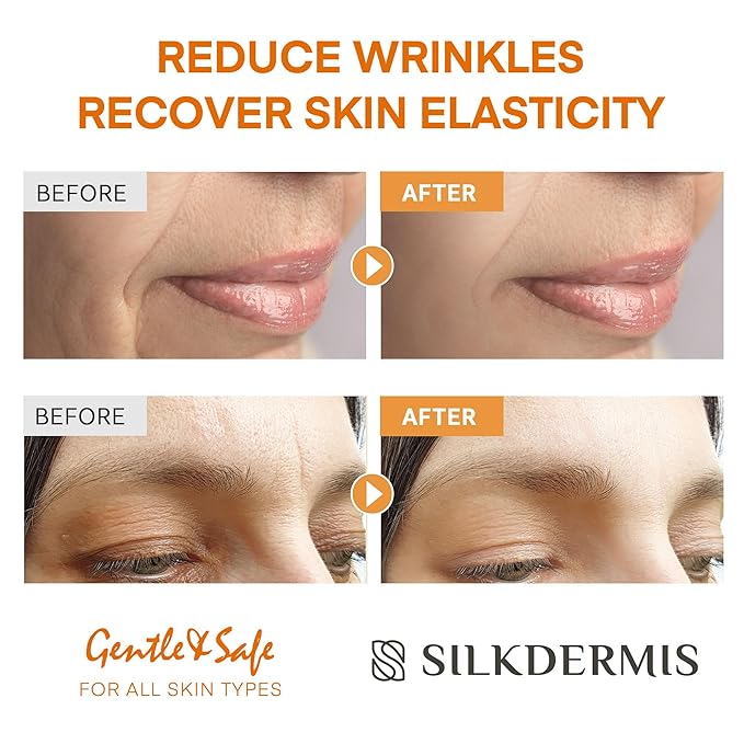 SILKDERMIS Forehead Wrinkle Patches with Triangle: For Smile Line and Under Eye-Anti Wrinkle Patches with Aloe, Collagen, Vitamin E 112pcs
