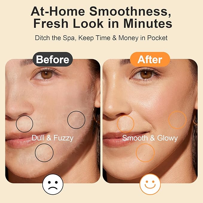 Sonic Smooth Dermaplane for Women Face, 2 in 1 Facial Exfoliation & Peach Fuzz Removal, 3-Speed Rechargeable Dermaplane Razor with LED Light and 13 Refill Dermablades, S