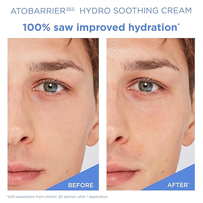 AESTURA ATOBARRIER365 Hydro Essence + Hydro Soothing Cream