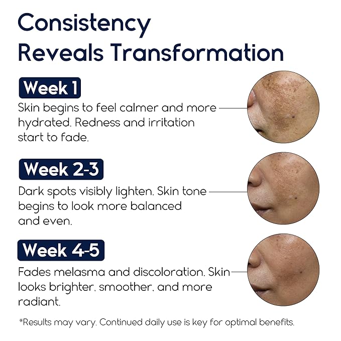 Meladerm Treatment for Face