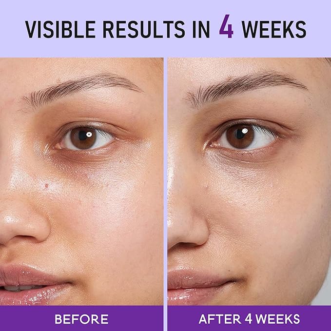 Caffeine Eye Cream for Dark Circles - 5% Caffeine Eye Serum Infused with Collagen and Niacinamide, Cream for Puffines and Bags Under Eyes w/ 360° Depuffer Roller