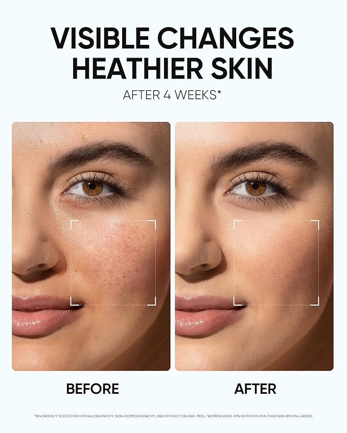 Face Moisturizer with 5X Ceramides, Hydrating Moisture Barrier Repair Cream for Sensitive/Oil Skin Types, Hyaluronic Acid & Centella, Daily Facial Moisturizer, Non-Comedogenic 30g/1 fl.oz