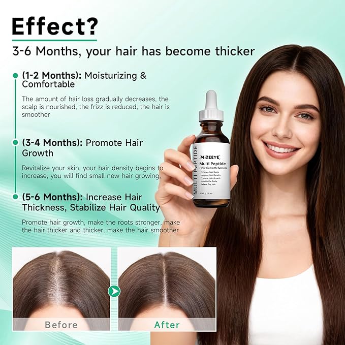 Hair Growth Serum for Thinning & Frizzy Hair, 30mL Vegan & Natural Multi Peptide Serum for Hair Growth, Suitable for Men & Women.