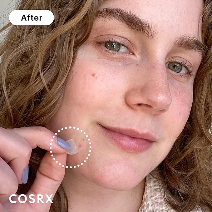 COSRX Pimple Care and Skin Recovery - Acne Pimple Patch 2 Pack (48 Counts) + Peptide Toner Serum, Acne Recovery and Hydration Boosting Skin Care for All Skin Types