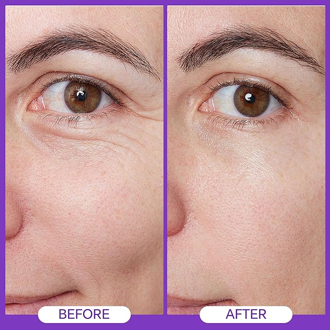 Eye Repair Cream 15ml - Peptide Complex Eye Cream with 3 Essential Ceramides, Niacinamide & Hyaluronic Acid, Dermatologist Developed Anti-Aging Eye Treatment for Fine Lines, Dark Circles.