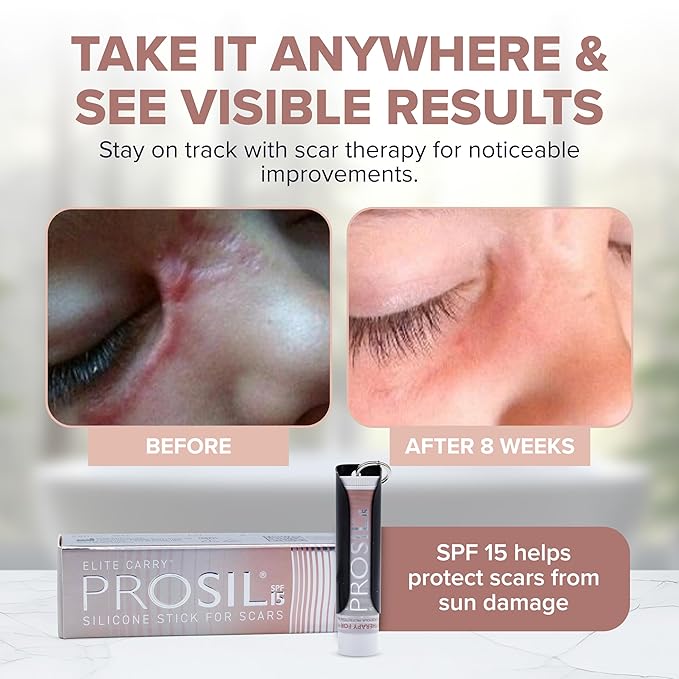ProSil Elite Carry with SPF 15 – Patented Scar Treatment in a Portable Keychain – Smooth Glide-On, Professional-Grade Silicone Scar Stick - Mess-Free, Travel-Friendly & Lightweight - Black Sleeve
