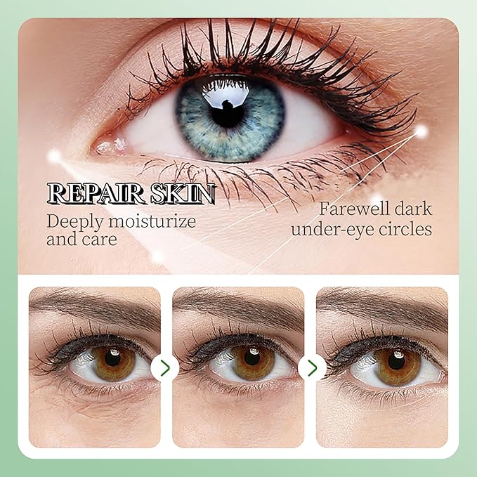 AKARY Aloe Vera Under Eye Patches for Dark Circles, Puffy Eyes & Wrinkles, 98% Aloe Essence & Collagen Infused Eye Masks, Smoothing, Hydrating, Firming Care, Fine Lines, Eye Bags Reduction (60 Pcs)