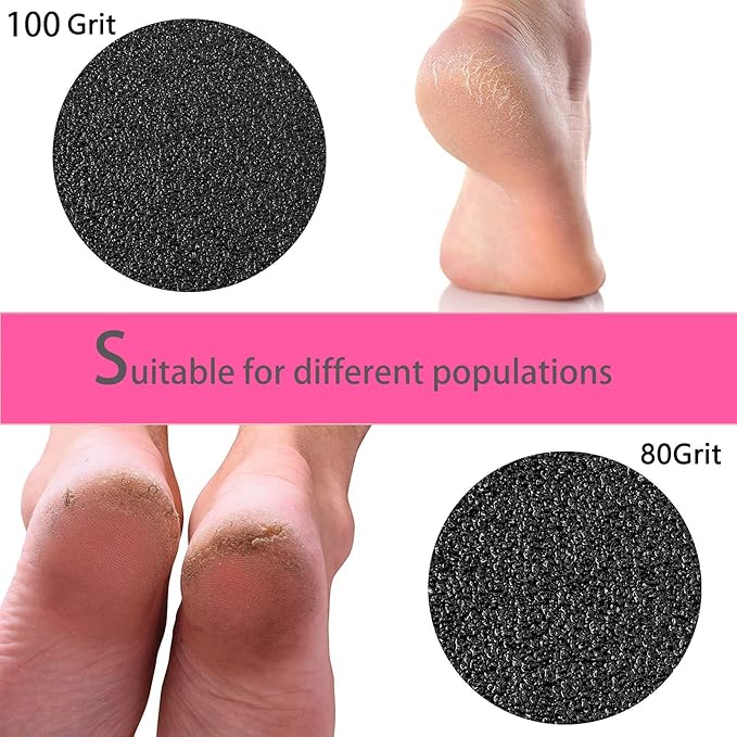 MOWLIE 60pcs Replaceable Sandpaper Refill Discs for Electric Foot File Callus Remover Hard Dry Dead Skin Removal (pink10)