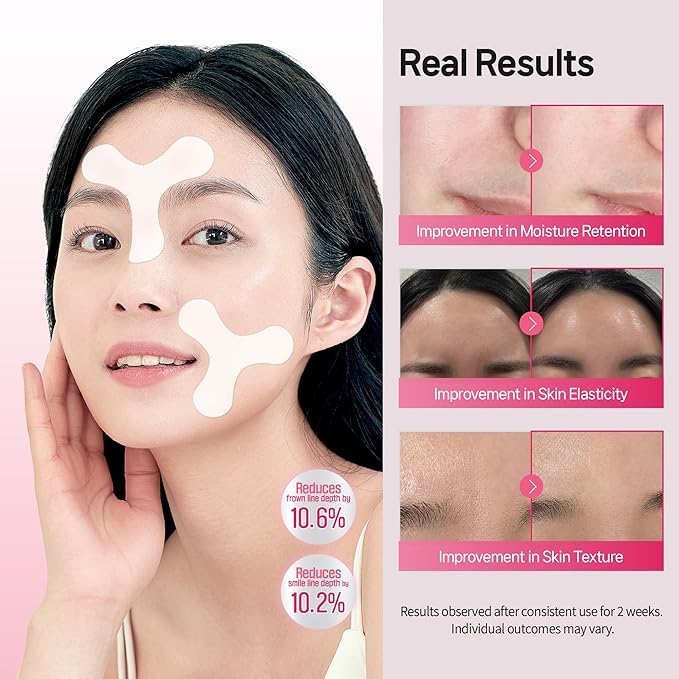 Facial Wrinkle Patches – 18pcs | Labottach Korean Skincare Hydrogel Firming Patch for Between Eyes, Smile Lines & Fine Lines with Adenosine, Tartaric Acid | Stretch & Lift | Home Skin Care