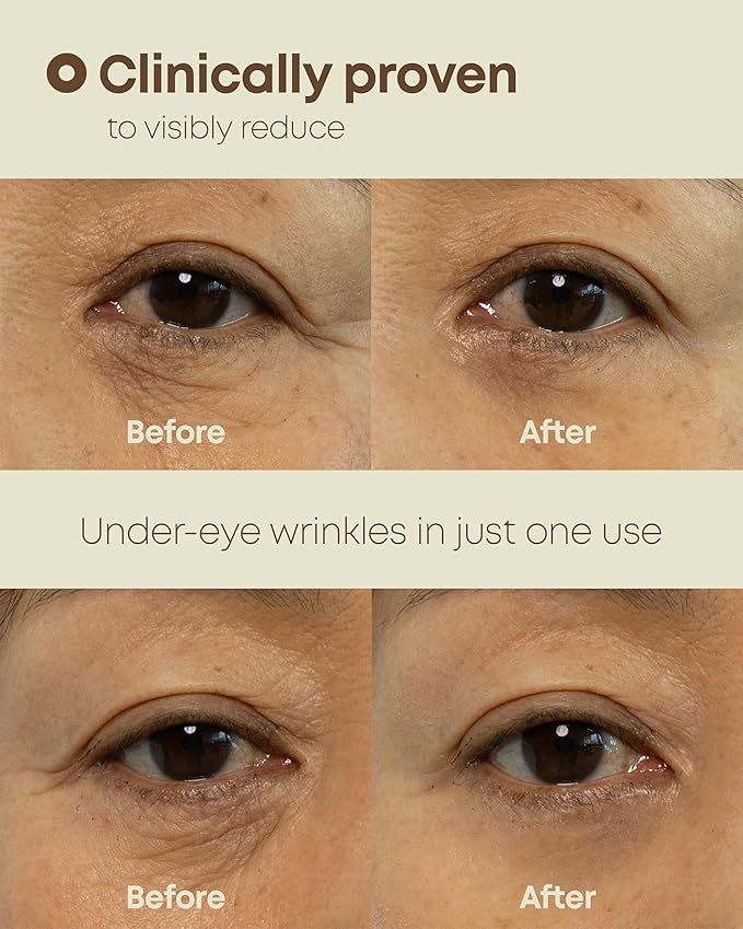 NINELESS Ever-Youth Dual Effect Eye Cream Korean Skincare Instant Lifting Technology for Firm Eyes with Niacinamide Adenosine Hyaluronic Acid Ceramides for Fine Lines Bags Puffiness 0.5 fl oz