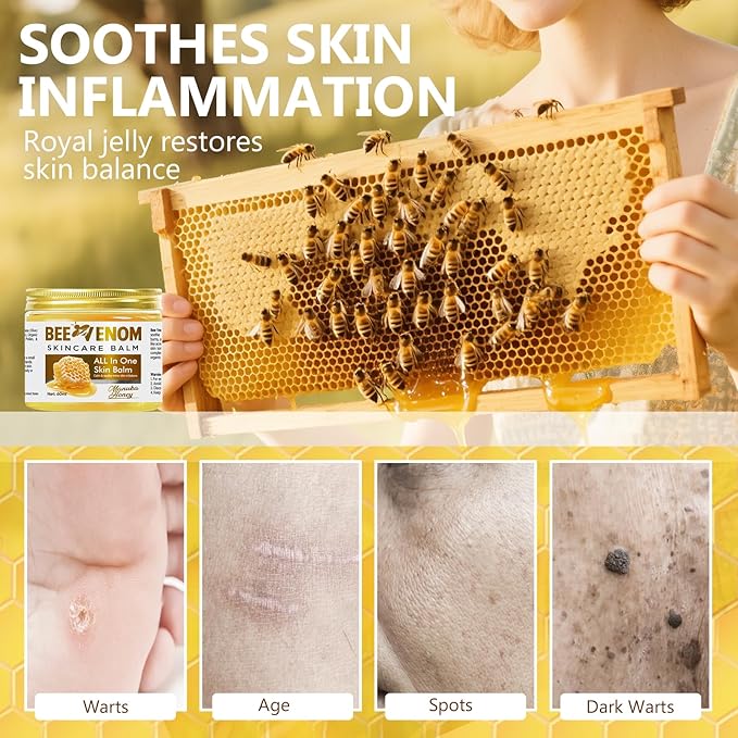 Bee Venom Skin Treatment Cream, Effective Skin Care, Bee Venom Cream with Natural Formula, Quickly Absorbing Moisturizer Suitable for All Skin Types, 2.1 fl oz