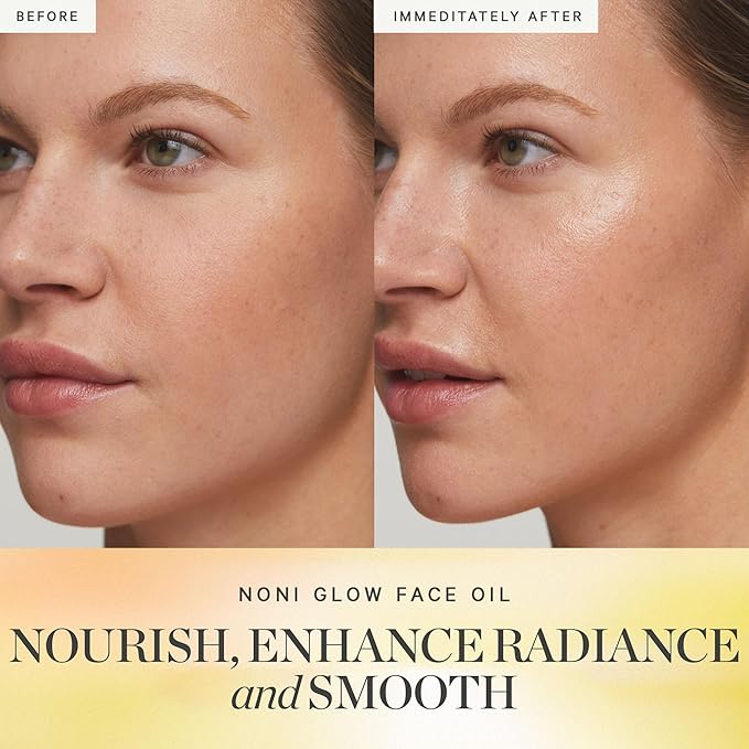 KORA Organics Noni Glow Hydrating Face Oil for All Skin Types, Lightweight Fast-Absorbing Facial Oil with Rosehip, Jojoba & Sea Buckthorn Oils for Smooth & Radiant Looking Skin, 1.69 fl oz