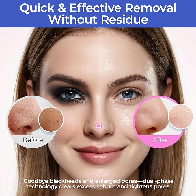 BEPHOLAN Deep Cleansing Oil, Hydrating Makeup Remover for Waterproof Makeup & Sunscreen, Sea Buckthorn Oil Cleanser with Jojoba & Camellia for Sensitive Skin, Pore Cleansing – 6.76fl oz